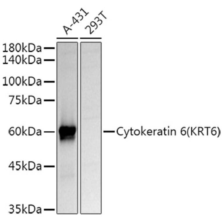 Western Blot - Anti-Cytokeratin 6a Antibody (A12136) - Antibodies.com