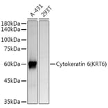 Western Blot - Anti-Cytokeratin 6a Antibody (A12136) - Antibodies.com