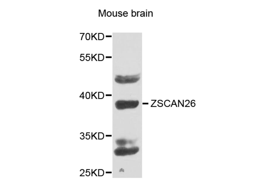 Western Blot - Anti-ZSCAN26 Antibody (A7571) - Antibodies.com
