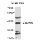 Western Blot - Anti-ZSCAN26 Antibody (A7571) - Antibodies.com
