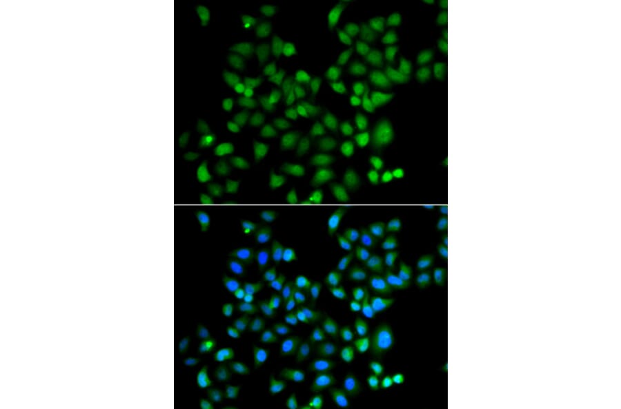 Immunofluorescence - Anti-ZSCAN26 Antibody (A7571) - Antibodies.com