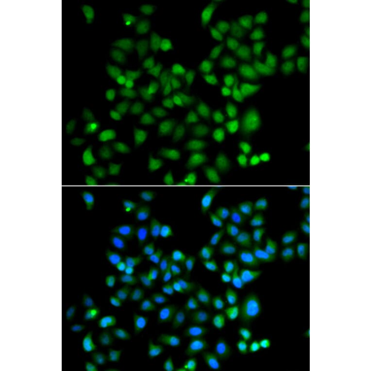 Immunofluorescence - Anti-ZSCAN26 Antibody (A7571) - Antibodies.com