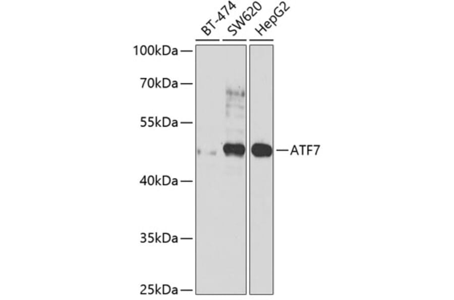 Western Blot - Anti-ATF7 Antibody (A12138) - Antibodies.com