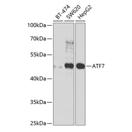 Western Blot - Anti-ATF7 Antibody (A12138) - Antibodies.com