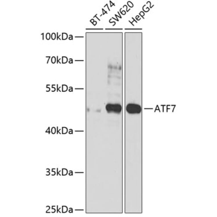 Western Blot - Anti-ATF7 Antibody (A12138) - Antibodies.com