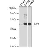 Western Blot - Anti-ATF7 Antibody (A12138) - Antibodies.com