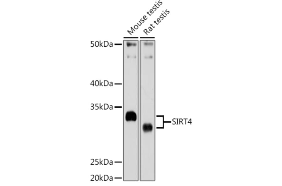 Western Blot - Anti-SIRT4 Antibody (A12140) - Antibodies.com
