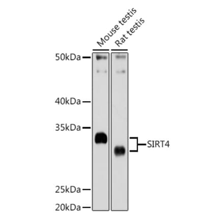 Western Blot - Anti-SIRT4 Antibody (A12140) - Antibodies.com