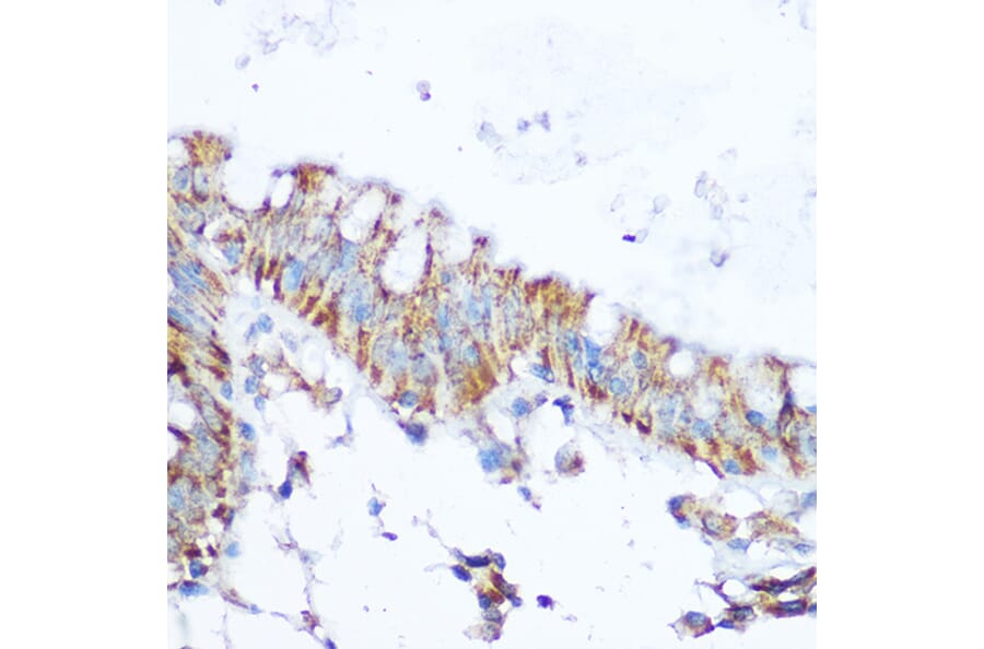 Immunohistochemistry - Anti-SIRT4 Antibody (A12140) - Antibodies.com