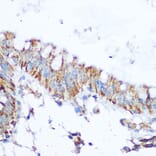 Immunohistochemistry - Anti-SIRT4 Antibody (A12140) - Antibodies.com
