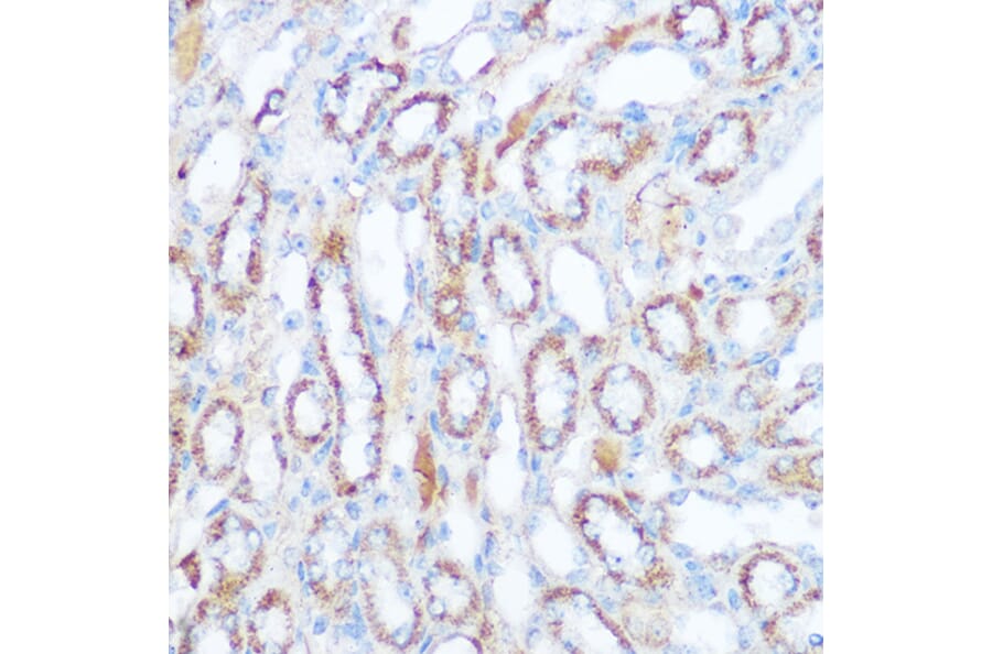 Immunohistochemistry - Anti-SIRT4 Antibody (A12140) - Antibodies.com