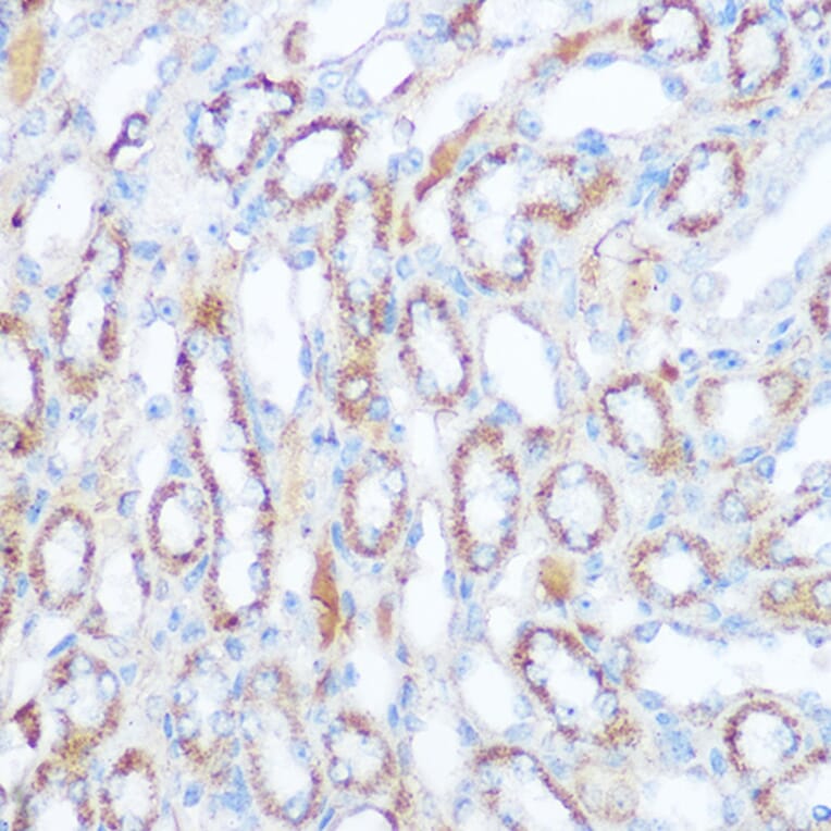 Immunohistochemistry - Anti-SIRT4 Antibody (A12140) - Antibodies.com