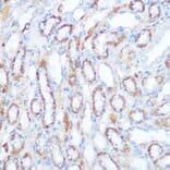 Immunohistochemistry - Anti-SIRT4 Antibody (A12140) - Antibodies.com