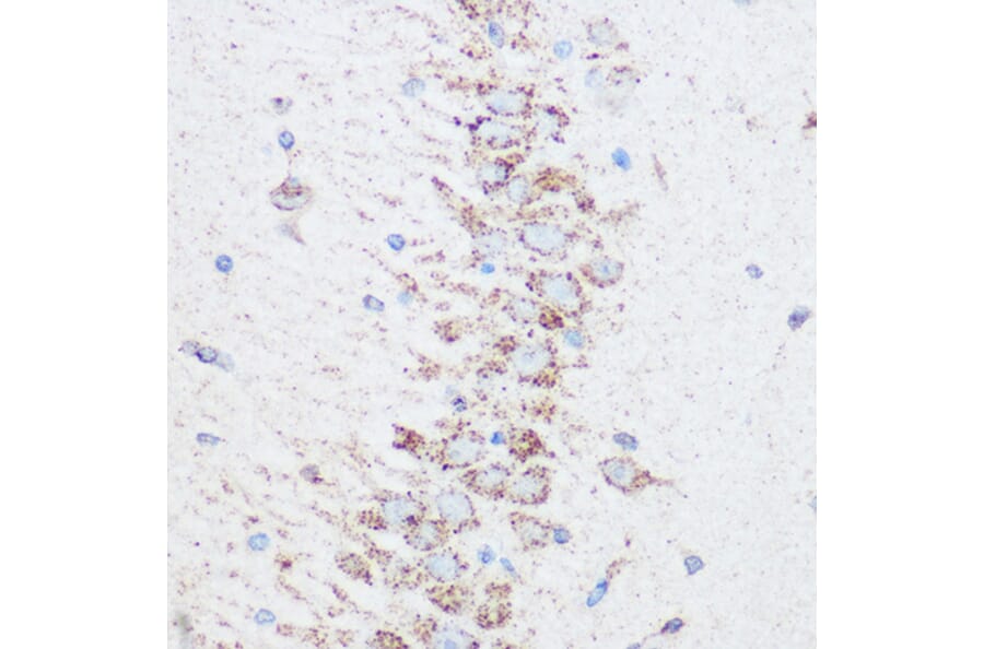 Immunohistochemistry - Anti-SIRT4 Antibody (A12140) - Antibodies.com