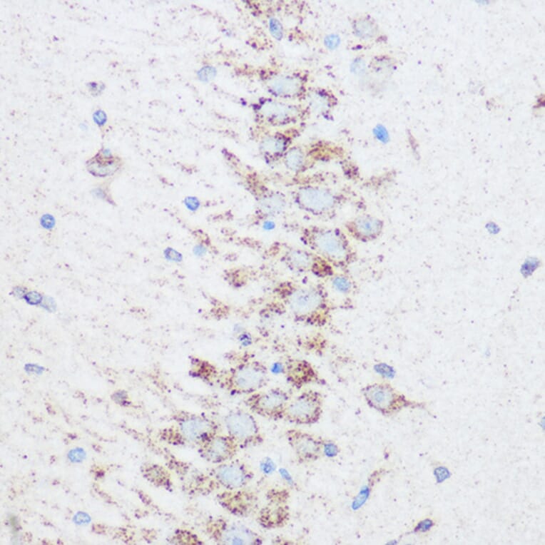Immunohistochemistry - Anti-SIRT4 Antibody (A12140) - Antibodies.com