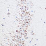 Immunohistochemistry - Anti-SIRT4 Antibody (A12140) - Antibodies.com