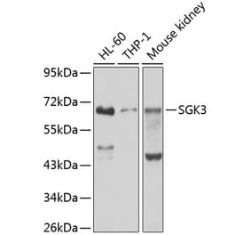 Western Blot - Anti-SGK3 Antibody (A12141) - Antibodies.com