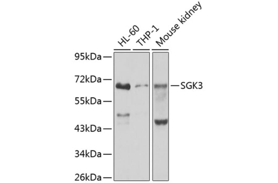 Western Blot - Anti-SGK3 Antibody (A12141) - Antibodies.com