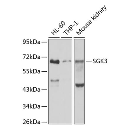 Western Blot - Anti-SGK3 Antibody (A12141) - Antibodies.com