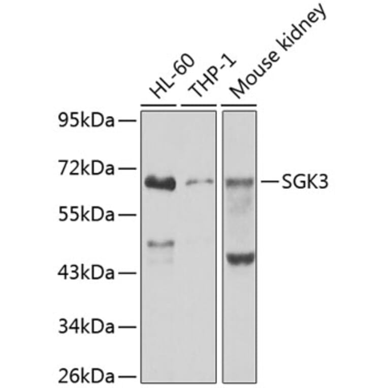 Western Blot - Anti-SGK3 Antibody (A12141) - Antibodies.com
