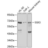 Western Blot - Anti-SGK3 Antibody (A12141) - Antibodies.com