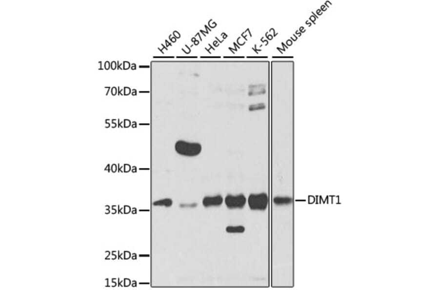 Western Blot - Anti-DIMT1L Antibody (A12142) - Antibodies.com