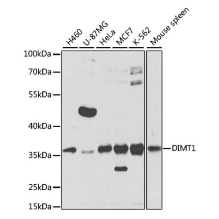 Western Blot - Anti-DIMT1L Antibody (A12142) - Antibodies.com