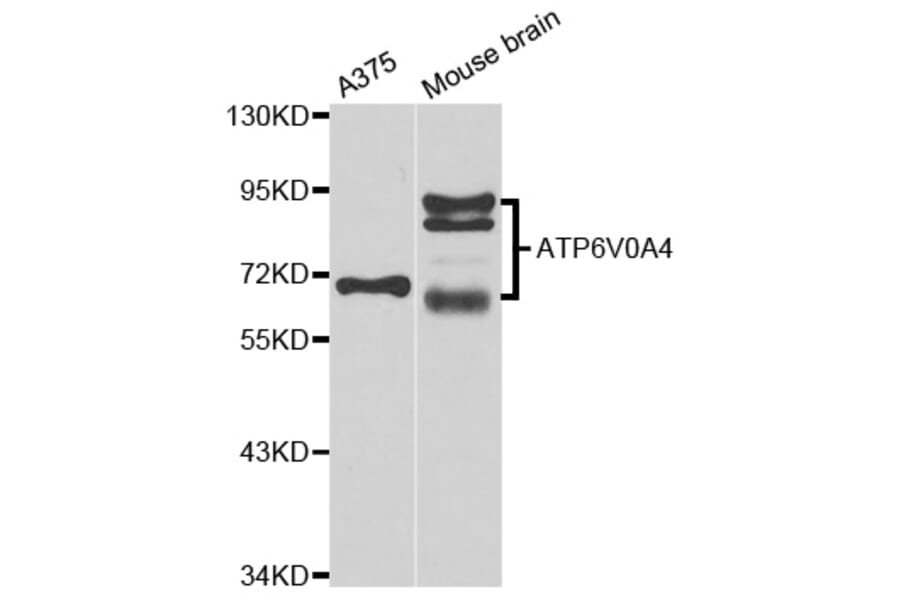 Western Blot - Anti-ATP6V0A4 Antibody (A7591) - Antibodies.com