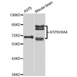 Western Blot - Anti-ATP6V0A4 Antibody (A7591) - Antibodies.com