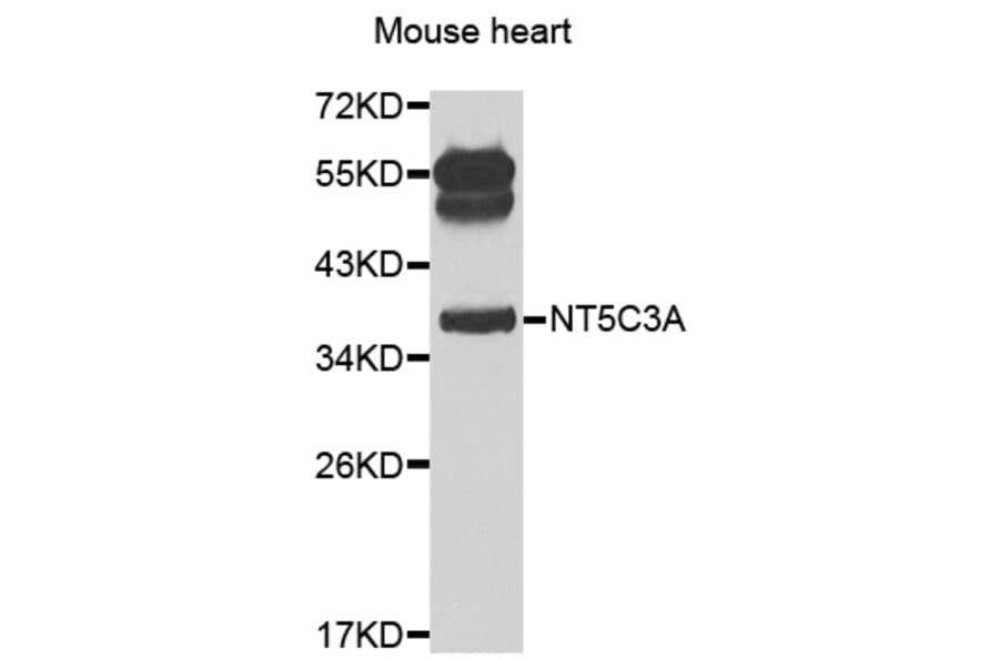 Western Blot - Anti-NT5C3A Antibody (A7593) - Antibodies.com