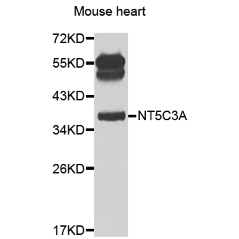Western Blot - Anti-NT5C3A Antibody (A7593) - Antibodies.com