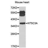 Western Blot - Anti-NT5C3A Antibody (A7593) - Antibodies.com