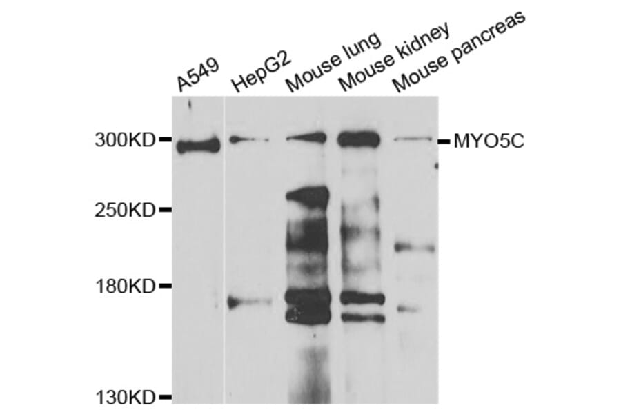 Western Blot - Anti-MYO5C Antibody (A7597) - Antibodies.com