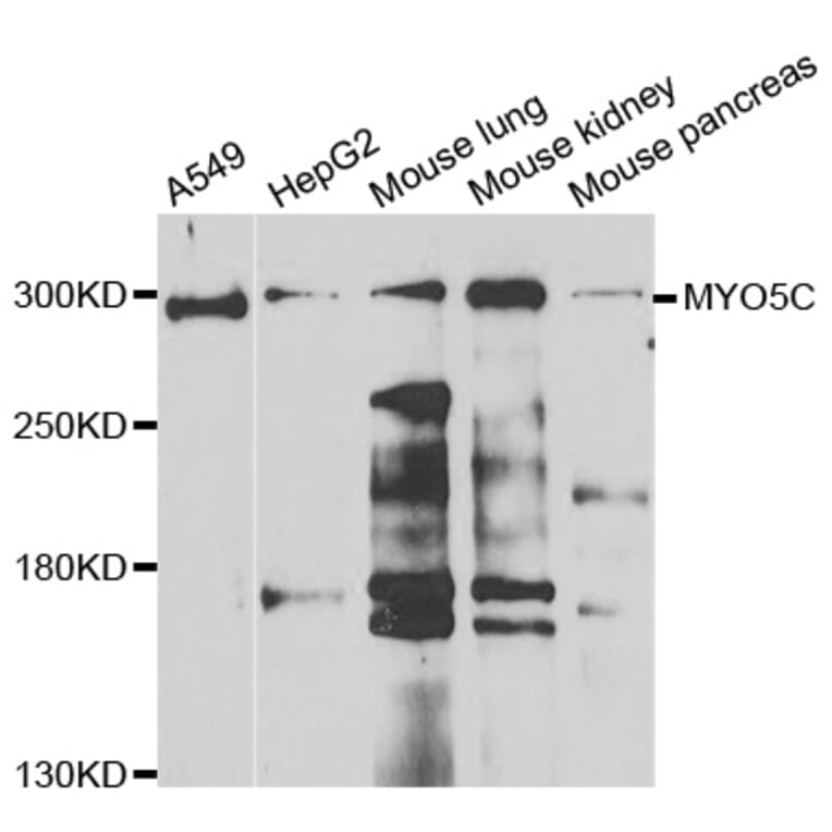 Western Blot - Anti-MYO5C Antibody (A7597) - Antibodies.com