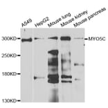 Western Blot - Anti-MYO5C Antibody (A7597) - Antibodies.com