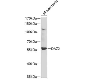 Western Blot - Anti-DAZ2 Antibody (A12146) - Antibodies.com