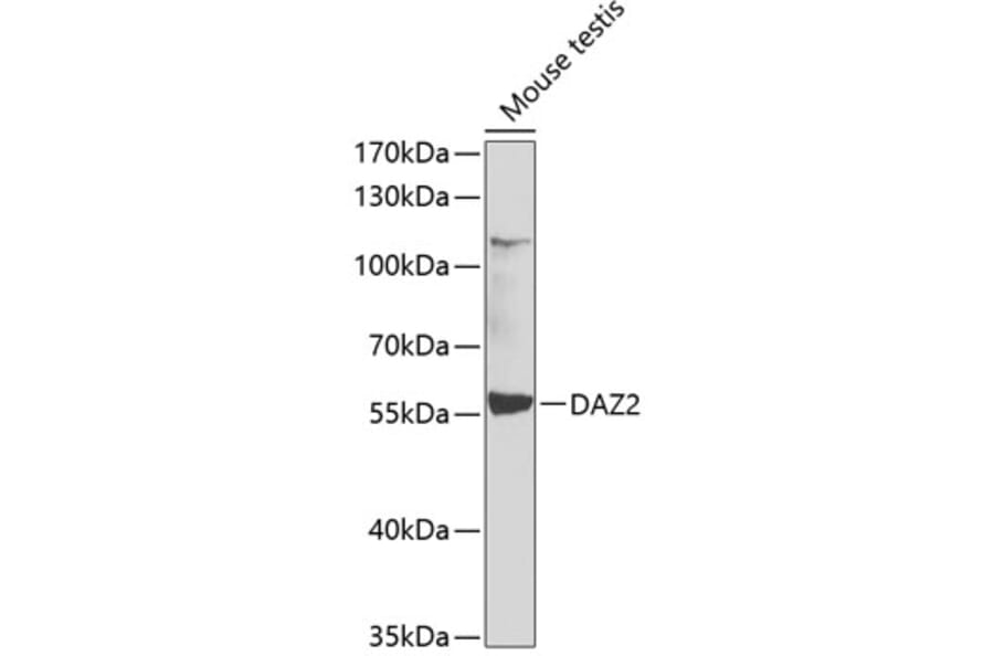 Western Blot - Anti-DAZ2 Antibody (A12146) - Antibodies.com