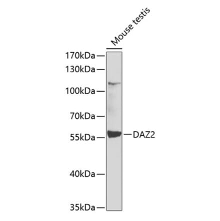 Western Blot - Anti-DAZ2 Antibody (A12146) - Antibodies.com