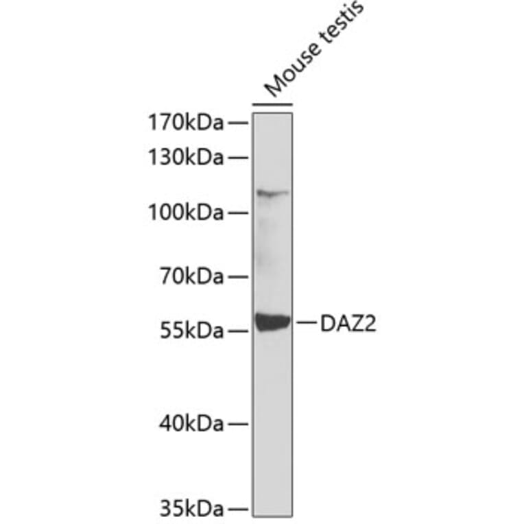 Western Blot - Anti-DAZ2 Antibody (A12146) - Antibodies.com