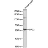 Western Blot - Anti-DAZ2 Antibody (A12146) - Antibodies.com