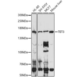 Western Blot - Anti-TET3 Antibody (A12148) - Antibodies.com