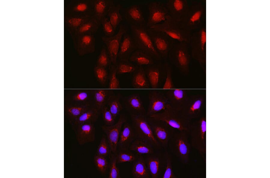 Immunofluorescence - Anti-TET3 Antibody (A12148) - Antibodies.com
