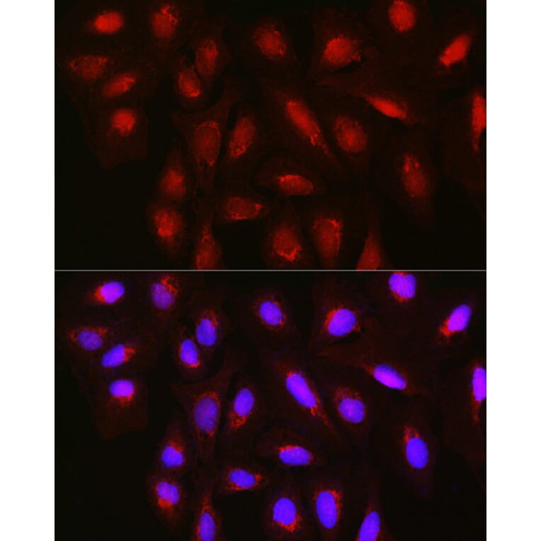 Immunofluorescence - Anti-TET3 Antibody (A12148) - Antibodies.com