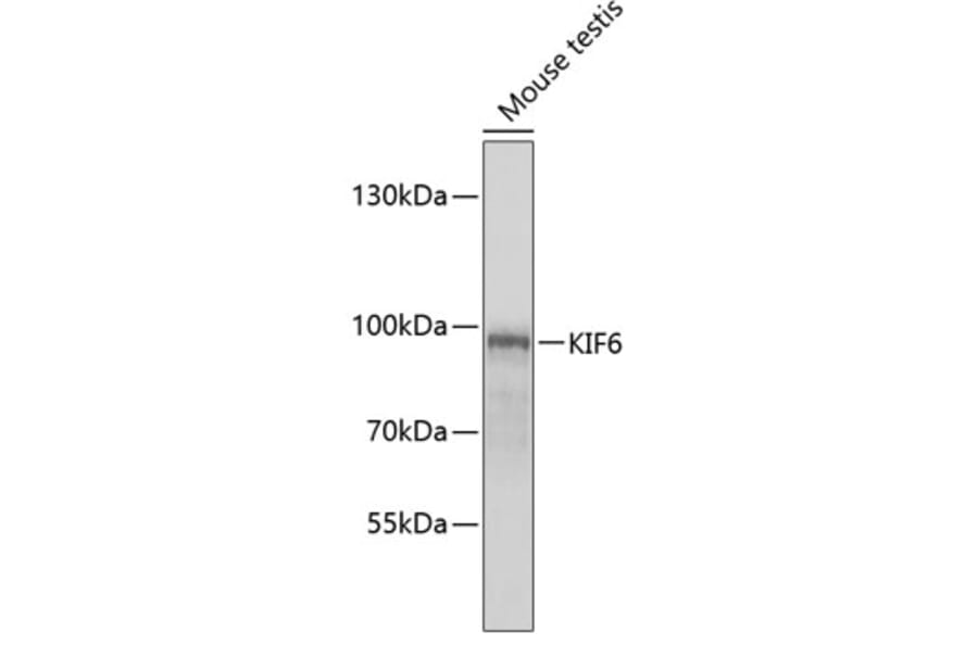 Western Blot - Anti-KIF6 / Kinesin-13 Antibody (A12149) - Antibodies.com