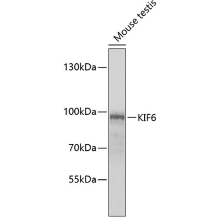 Western Blot - Anti-KIF6 / Kinesin-13 Antibody (A12149) - Antibodies.com