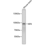 Western Blot - Anti-KIF6 / Kinesin-13 Antibody (A12149) - Antibodies.com