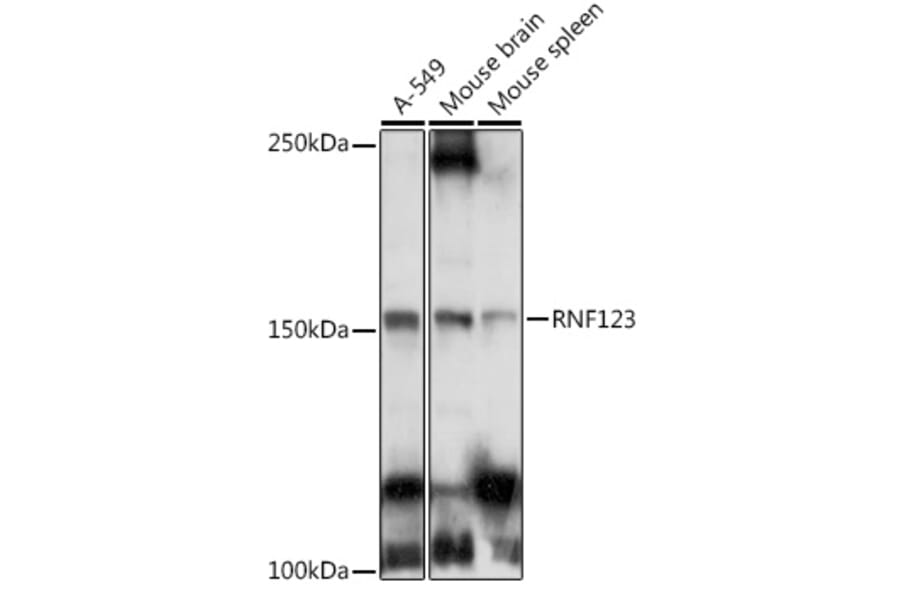 Western Blot - Anti-RNF123 Antibody (A12150) - Antibodies.com