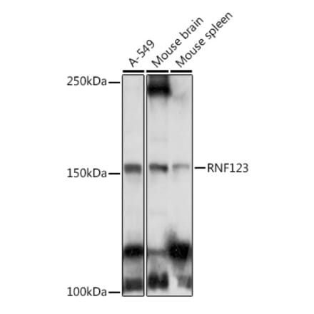 Western Blot - Anti-RNF123 Antibody (A12150) - Antibodies.com