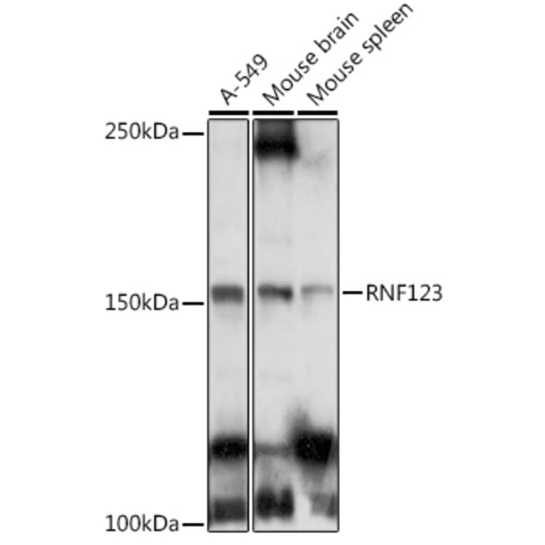 Western Blot - Anti-RNF123 Antibody (A12150) - Antibodies.com