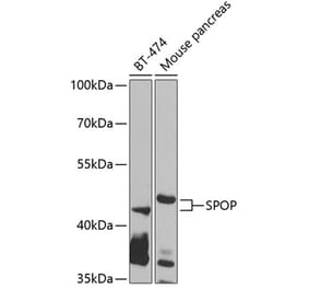 Western Blot - Anti-SPOP Antibody (A12151) - Antibodies.com